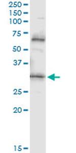 PDYN Antibody in Immunoprecipitation (IP)
