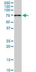 PDZK1 Antibody in Western Blot (WB)