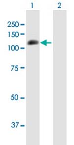 PECAM1 Antibody in Western Blot (WB)