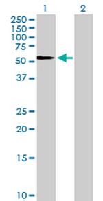 SERPINF1 Antibody in Western Blot (WB)
