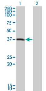 PEX10 Monoclonal Antibody (1B8)