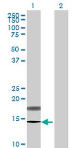 PFDN4 Polyclonal Antibody, MaxPab™