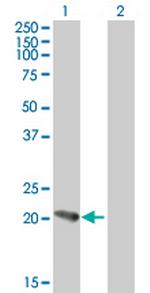 PFDN5 Antibody in Western Blot (WB)
