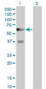 PFKFB3 Monoclonal Antibody (3F3)