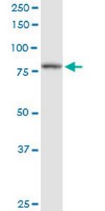 PFKP Polyclonal Antibody, MaxPab™