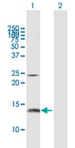 PFN2 Polyclonal Antibody, MaxPab™