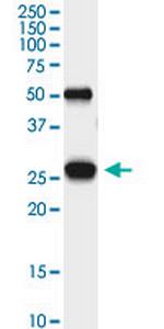 PGAM1 Monoclonal Antibody (4F5-D8)
