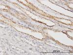 PGGT1B Antibody in Immunohistochemistry (Paraffin) (IHC (P))