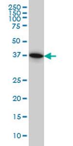 PGGT1B Antibody in Western Blot (WB)