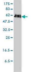 PGM3 Monoclonal Antibody (1E2-1B12)