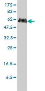 PGM3 Antibody in Western Blot (WB)