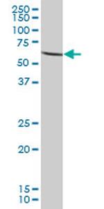 PGM5 Antibody in Western Blot (WB)