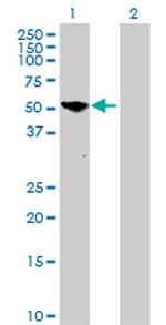 PGM5 Polyclonal Antibody, MaxPab™