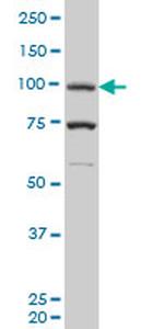 PGR Antibody in Western Blot (WB)
