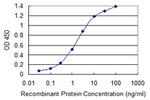 ABCB1 Monoclonal Antibody (1F11)