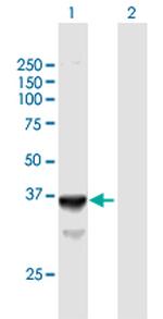 SLC25A3 Polyclonal Antibody, MaxPab™