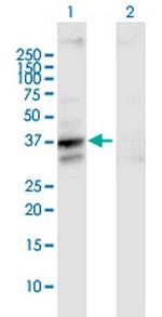 SLC25A3 Polyclonal Antibody, MaxPab™