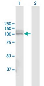 PHEX Polyclonal Antibody, MaxPab™