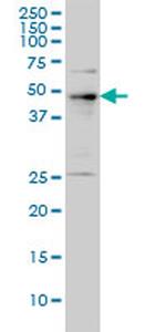 PHF1 Monoclonal Antibody (2D3)