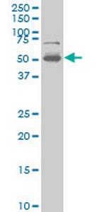 PHF1 Monoclonal Antibody (2A12)