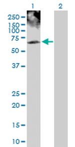 PHKG2 Polyclonal Antibody, MaxPab™