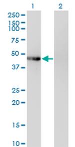 PHKG2 Monoclonal Antibody (2F4)