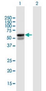 SERPINA1 Antibody in Western Blot (WB)