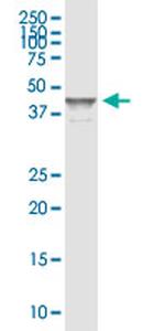 SERPINB5 Antibody in Western Blot (WB)