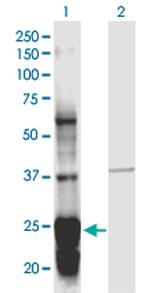 SERPINB5 Antibody in Western Blot (WB)