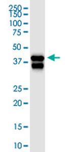 SERPINB5 Antibody in Western Blot (WB)