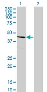 SERPINE2 Monoclonal Antibody (3G12)