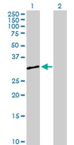 SERPINB8 Antibody in Western Blot (WB)