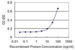 SERPINI1 Monoclonal Antibody (1E10)