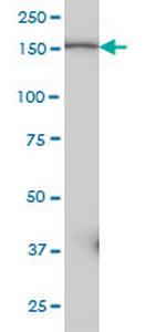 PIK3C2B Monoclonal Antibody (3E5)