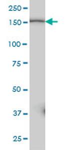 PIK3C2B Antibody in Western Blot (WB)