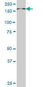 PIK3C2B Antibody in Western Blot (WB)