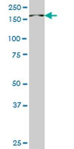 PIK3C2B Antibody in Western Blot (WB)