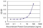PIM1 Monoclonal Antibody (6C8)