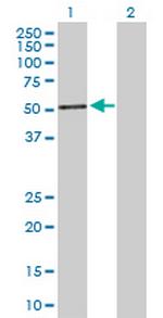 PIK3R1 Antibody in Western Blot (WB)