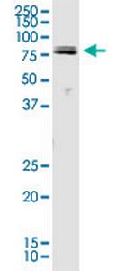 PIK3R1 Monoclonal Antibody (1C10)