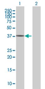 PITX1 Polyclonal Antibody, MaxPab™
