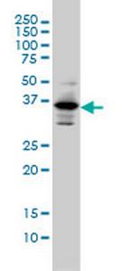 PITX1 Monoclonal Antibody (5G4)