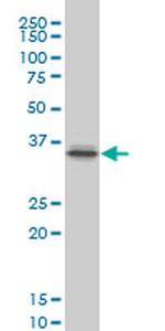 PITX1 Monoclonal Antibody (6D4)