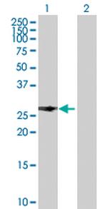 PITX2 Polyclonal Antibody, MaxPab™