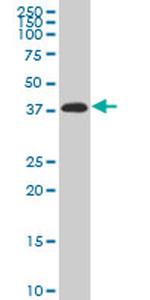 PITX2 Monoclonal Antibody (3D2)