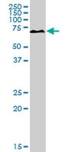 PKLR Antibody in Western Blot (WB)