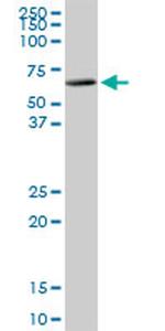 PKLR Antibody in Western Blot (WB)