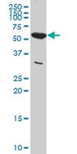 PKM2 Antibody in Western Blot (WB)