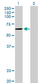 PKNOX1 Polyclonal Antibody, MaxPab™
