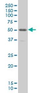 PKNOX1 Monoclonal Antibody (4F6)
